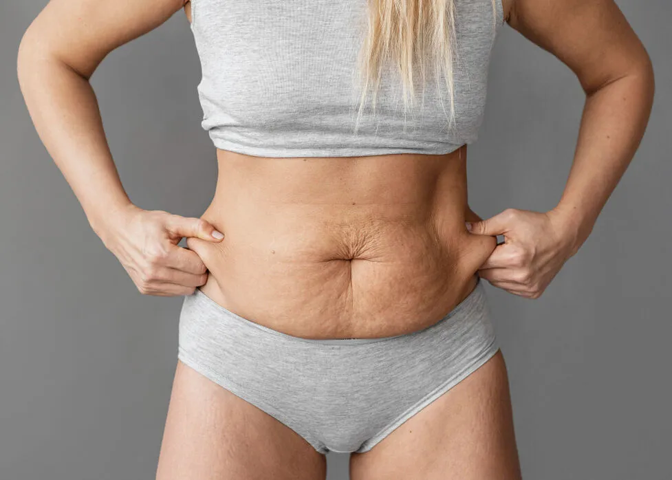 Abdominoplasty procedure