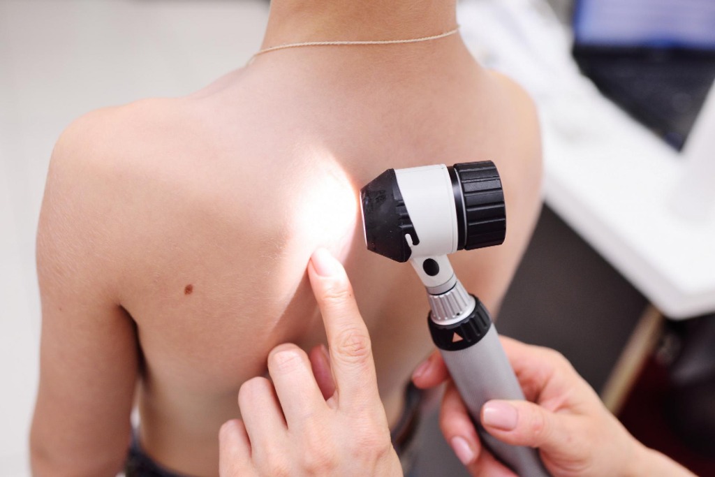 Kožní vyšetření